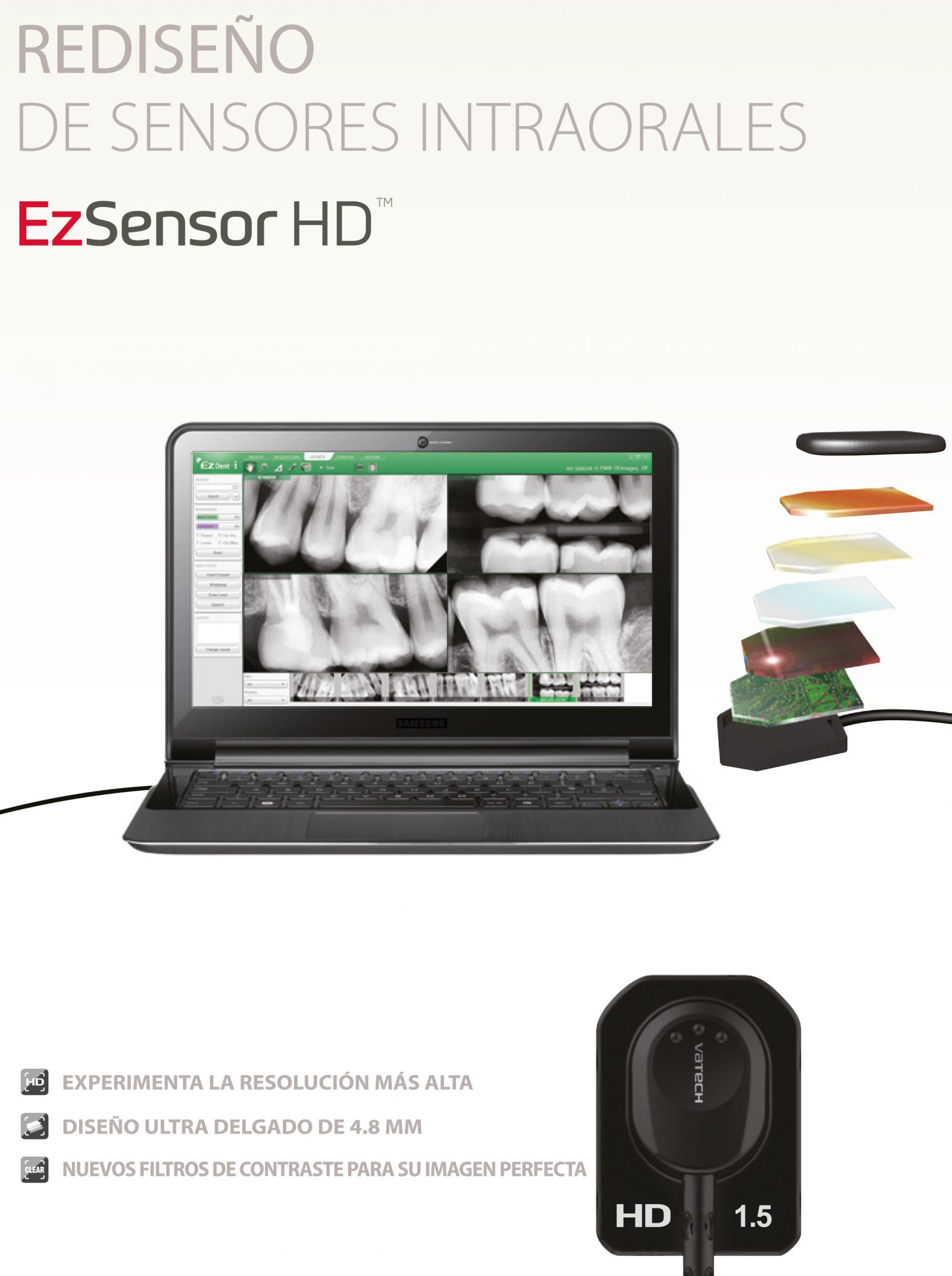 Captador intraoral EzSensor HD Vatech