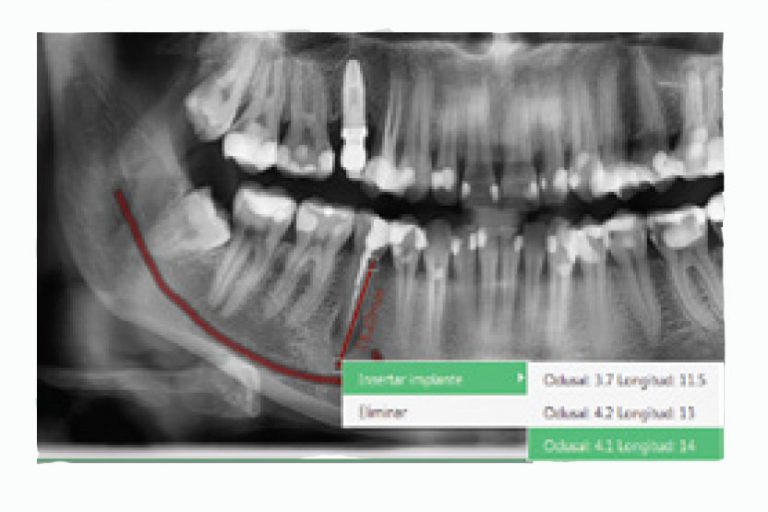SOFTWARE EzDenti DE VATECH Rogersan