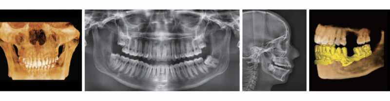 Rayos X dental precio Green 16/18 4 en 1