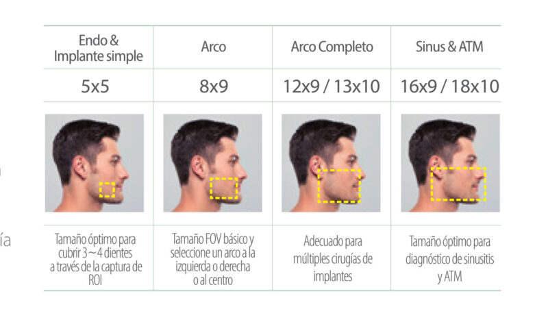 Rayos X dental precio Multi FOV Green 16/18 de Vatech