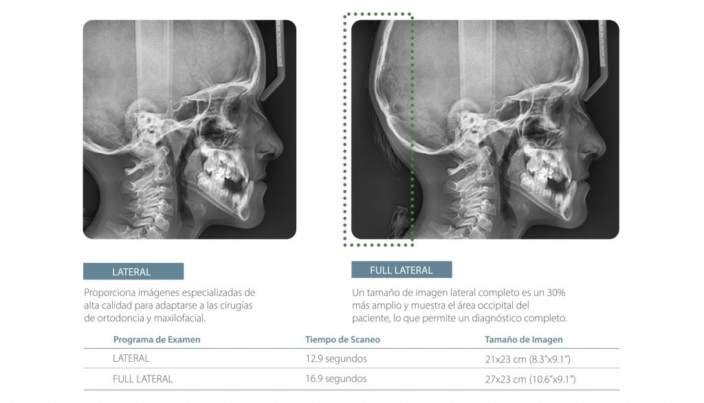 Cefalometria lateral y full lateral ortodoncia Pax-i de Vatech