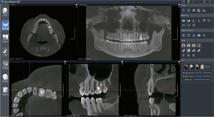 Incorpora IA Bondream3D.