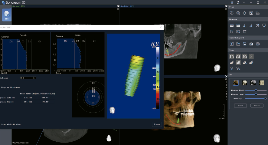 Software de cirugía dental del Tele panorámico de Bondent.