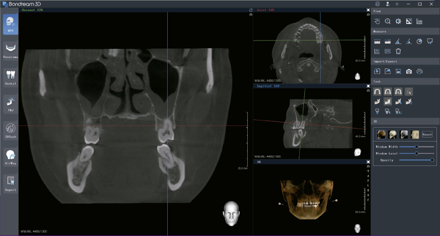 El mejor Software tratamiento de imágenes 3D Bondream3D.